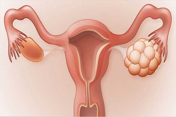 Gynecology
