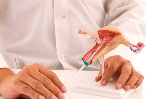 Gynecology
