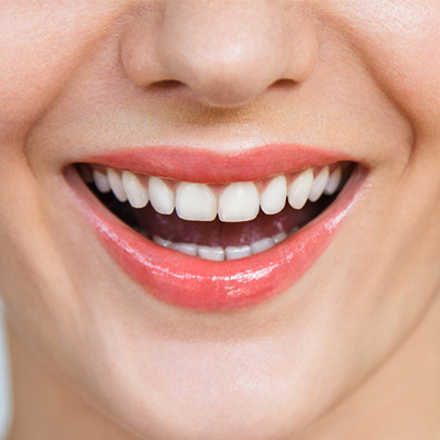 Bluetooth Dental