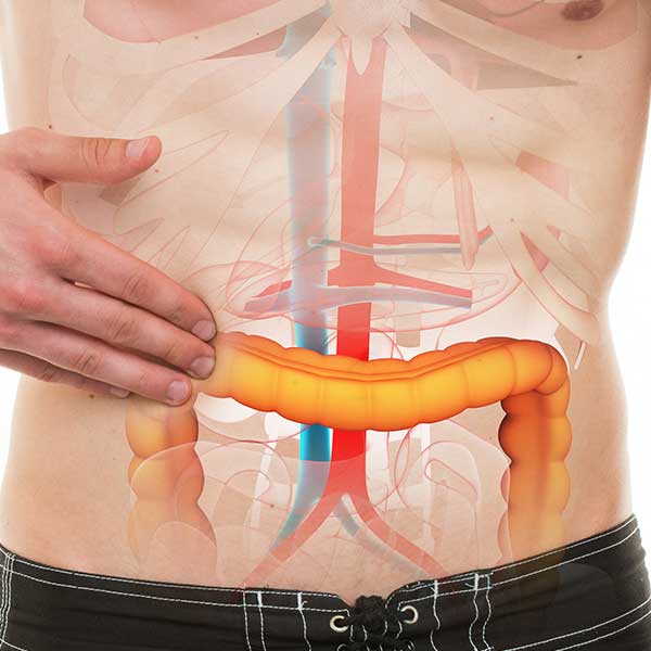 hernia