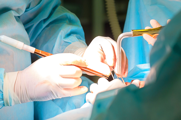 hernia