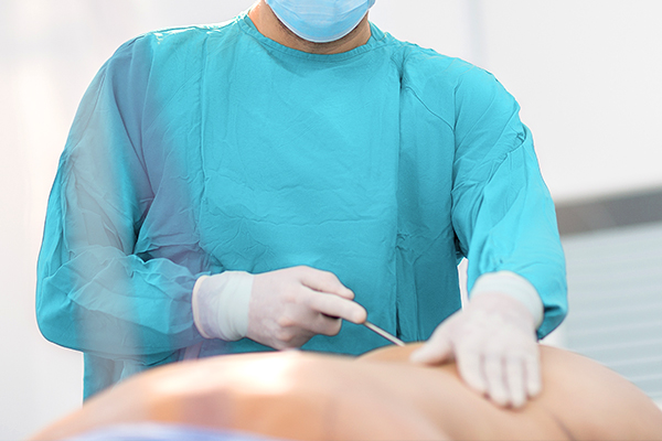 hernia
