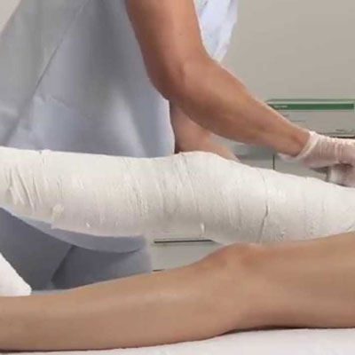 Knee Aliments
