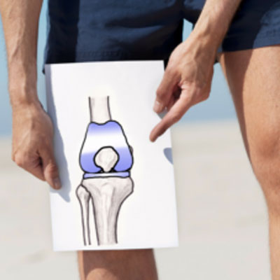 Knee Aliments