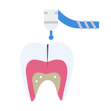 smile designing