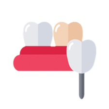 smile designing