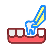 smile designing