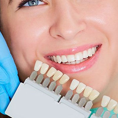 aligners