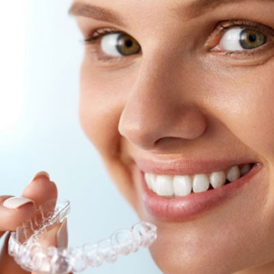aligners