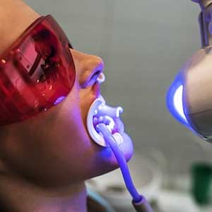 Laser Dental Treatments