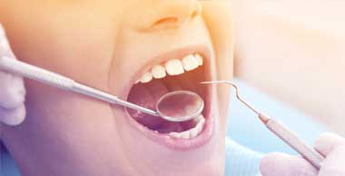 Dental Implant Treatments