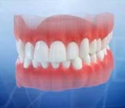Digital Dental Implants