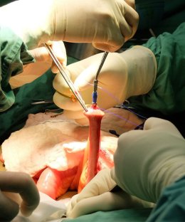 Surgeries