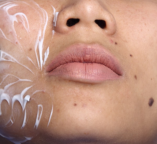 skin