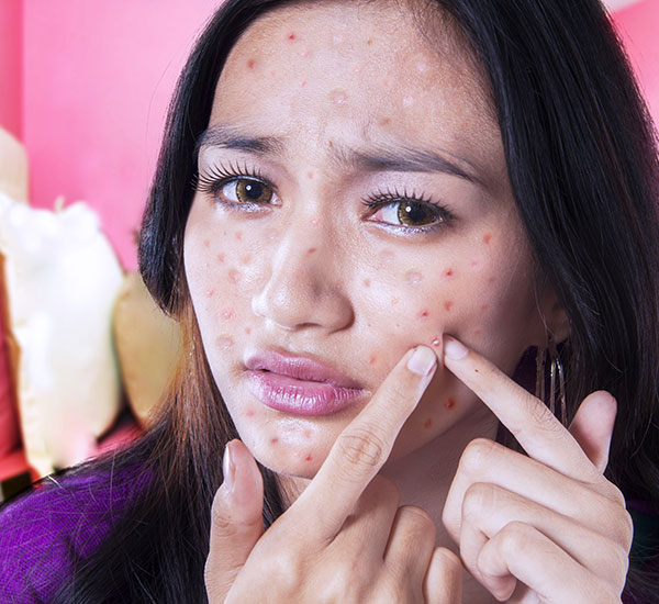skin