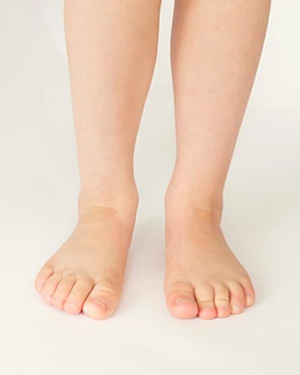 lower limb