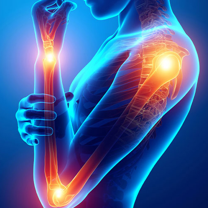 upper limb