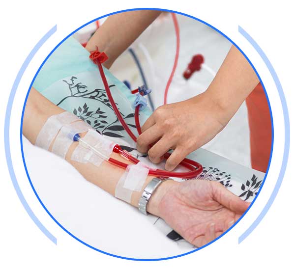Kidney Transplant