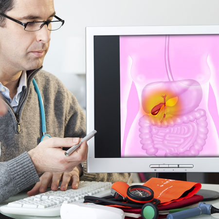 hernia