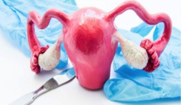 laparoscopy