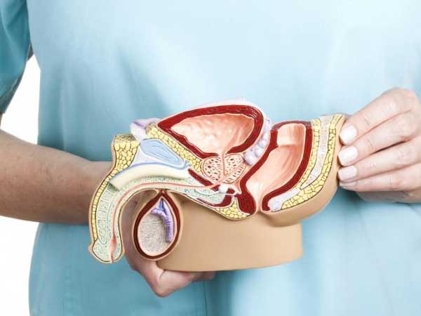 male infertility