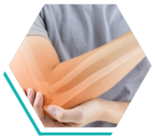  joint replacement