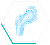  joint replacement