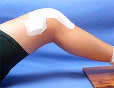 Knee Replacements