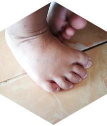 Paediatric