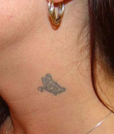 Laser Dermatology