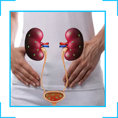 male urology