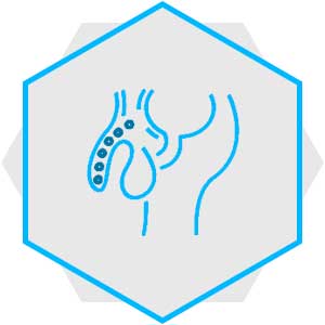 Uro-oncology