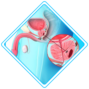 pediatric urology